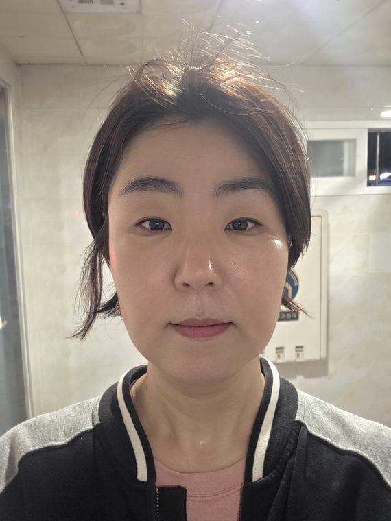 Example after photo: the same person at the same angle, distance and lighting as the before photo.